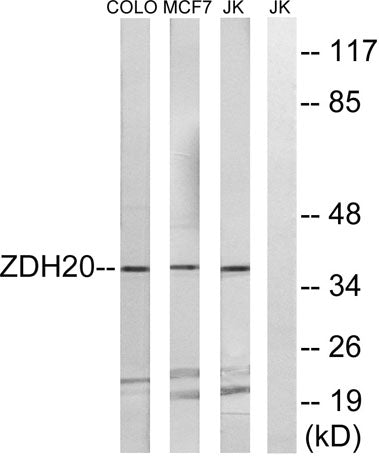 ZDHHC20 rabbit pAb