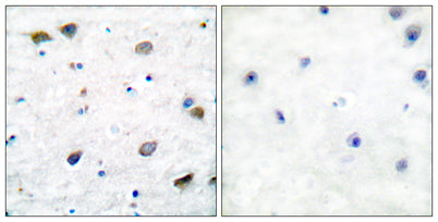GABAA Rβ1 rabbit pAb