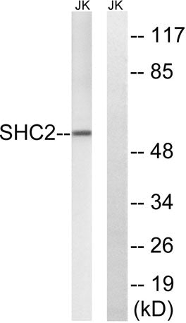 Sck rabbit pAb