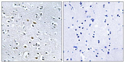 Nephrocystin-4 rabbit pAb