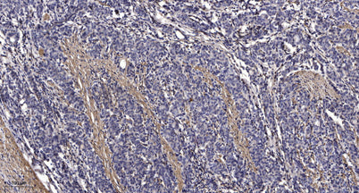 PTP22 rabbit pAb