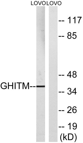 GHITM rabbit pAb