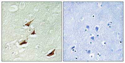 Pdcd-4 (phospho Ser67) rabbit pAb