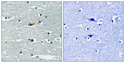 SPAK (phospho Ser309) rabbit pAb