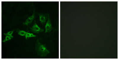 GnRH-R rabbit pAb