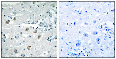 cPLA2-δ rabbit pAb