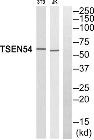 TSEN54 rabbit pAb