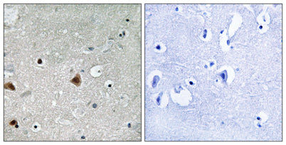 CSN1 (phospho Ser454) rabbit pAb