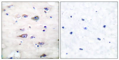 GluR-2 (phospho Ser880) rabbit pAb