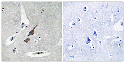 GluR-δ1 rabbit pAb