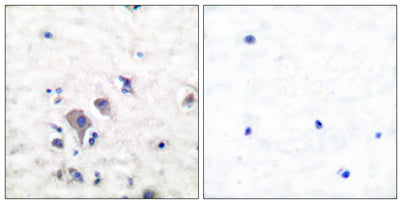 mGluR-2/3 rabbit pAb