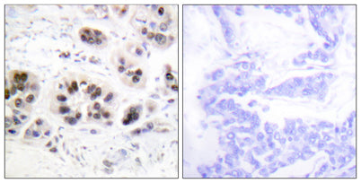 Acetyl Histone H2A (K5) rabbit pAb