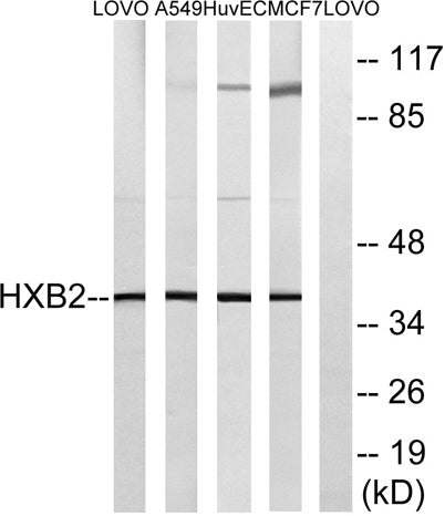 HoxB2 rabbit pAb
