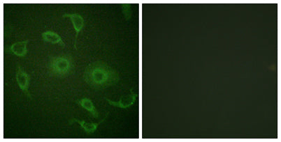IFN-α/βRα rabbit pAb