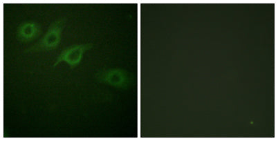 IFN-γRα rabbit pAb