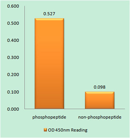 Insulin R (phospho Thr1375) rabbit pAb