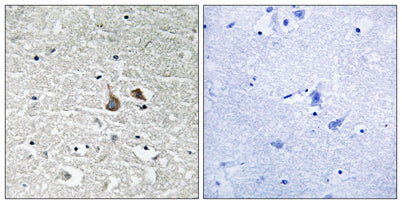 IRAK-1 (phospho Ser376) rabbit pAb