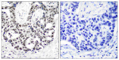 AR (phospho Ser650) rabbit pAb