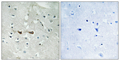 Integrin α4 (phospho Ser1027) rabbit pAb