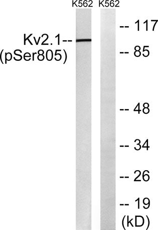 KV2.1 (phospho Ser805) rabbit pAb