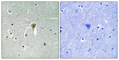 KIR6.2 (phospho Thr224) rabbit pAb