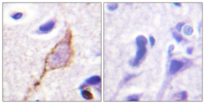 KCNQ2/3/4/5 rabbit pAb