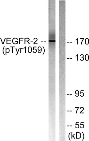 Flk-1/VEGFR2 (phospho Tyr1059) rabbit pAb