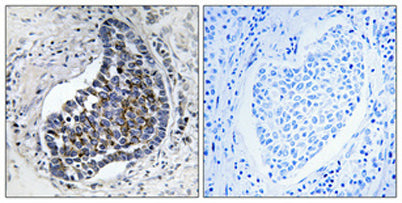 Cytokeratin 8 rabbit pAb