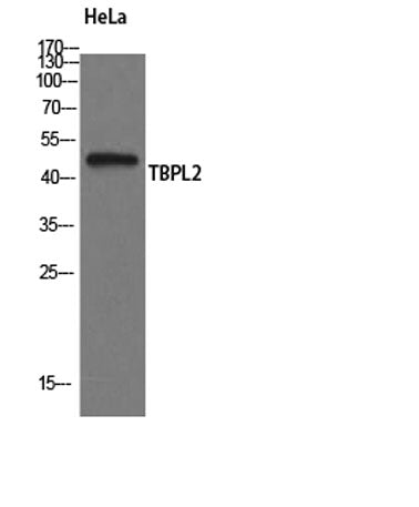 TBPL2 rabbit pAb