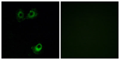 Olfactory receptor 11L1 rabbit pAb