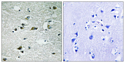 Casein Kinase Iγ1/2/3 (phospho Tyr263) rabbit pAb