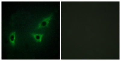 ATP7B rabbit pAb
