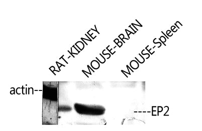 EP2 rabbit pAb