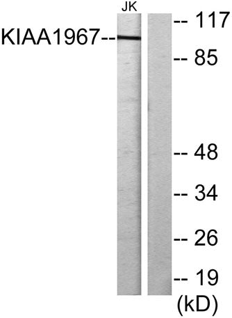 DBC-1 rabbit pAb