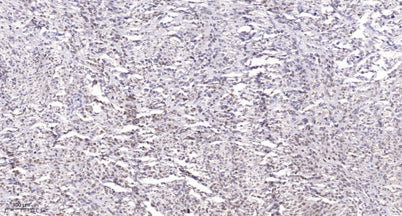 Rb (phospho Ser788) rabbit pAb
