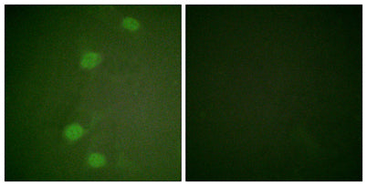 Rb (phospho Ser249) rabbit pAb