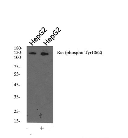 Ret (phospho Tyr1062) rabbit pAb