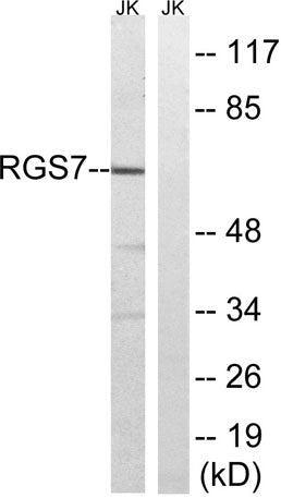 RGS7 rabbit pAb