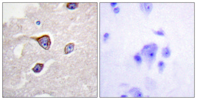 GRK 1 (phospho Ser21) rabbit pAb