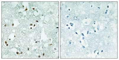 RNase Z2 rabbit pAb