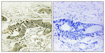 Rsk-1 (phospho Thr573) rabbit pAb