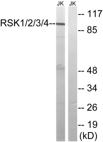 Rsk-1/2/3/4 rabbit pAb