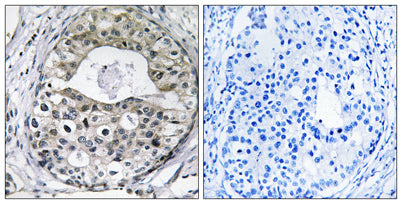 Ribosomal Protein S13 rabbit pAb