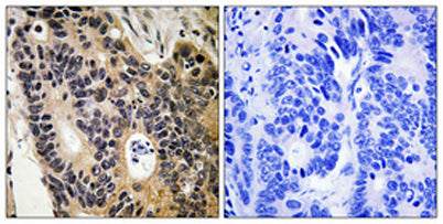 ENaC β rabbit pAb