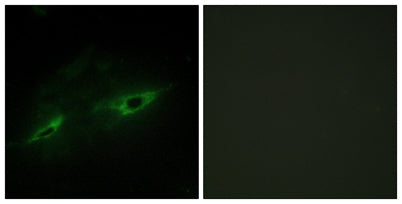 Cadherin-22 rabbit pAb
