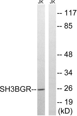 SH3BGR rabbit pAb