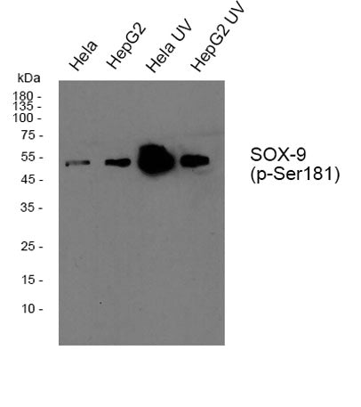 Sox-9 (phospho Ser181) rabbit pAb