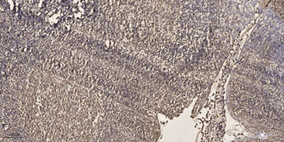 SRF (phospho Thr159) rabbit pAb
