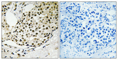SSB (phospho Ser366) rabbit pAb