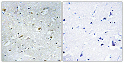 TACC1 rabbit pAb